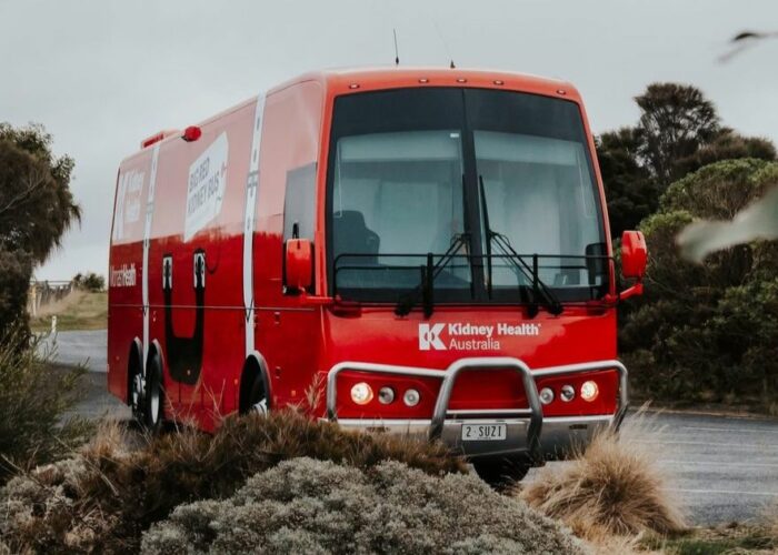 Mobile dialysis service