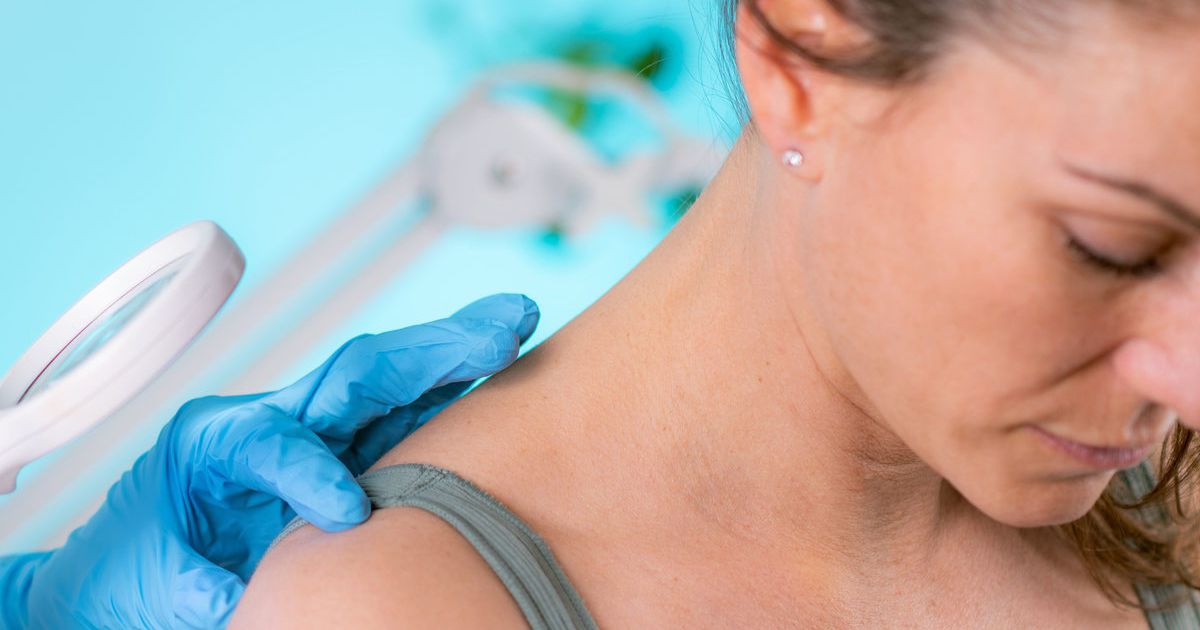Free Skin Checks
