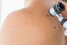 free skin checks Bacchus Marsh