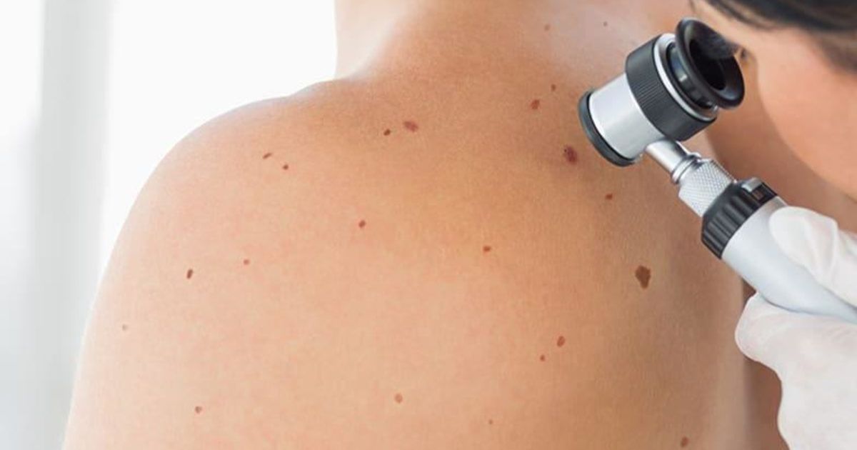 free skin checks Bacchus Marsh